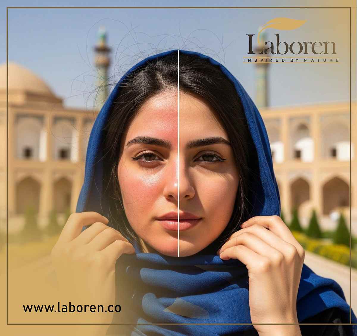 بدون ضدآفتاب چه بر سر پوستتان می‌آید